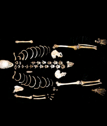 autopsia